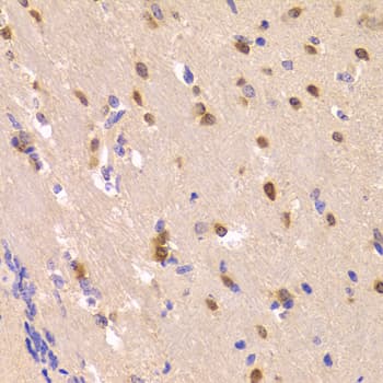 ROCK2 Antibody