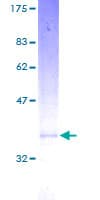 Human MGST3 Protein (Recombinant GST)