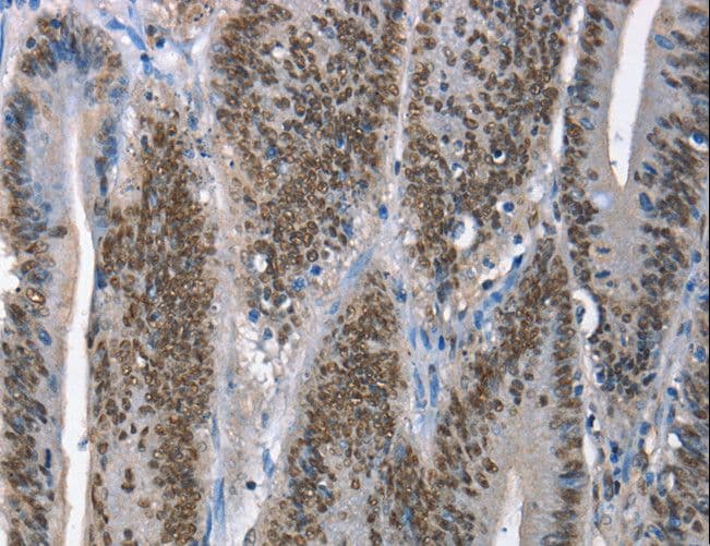 GNRH Antibody
