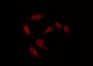 NIM1K / NIM1 Antibody