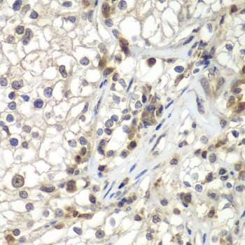 UBXD9 / ASPL Antibody (aa284-553)