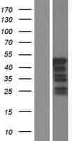 VPS37C Protein (Over-Expression Lysate Myc-DDK (Flag))