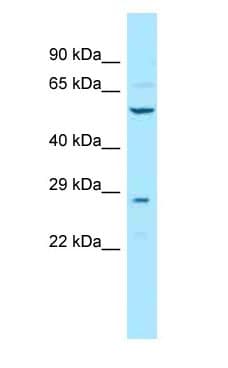 TCBE / KCS / HRD Antibody (aa34-83)