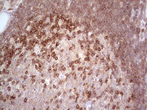 Monoclonal Mouse anti-Human MCPH1 Antibody (clone OTI2A3, aa1-264, IHC, WB)