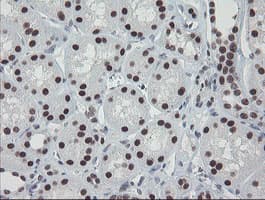 Monoclonal Mouse anti-Human TPRKB Antibody (clone OTI1E9, IHC, WB)