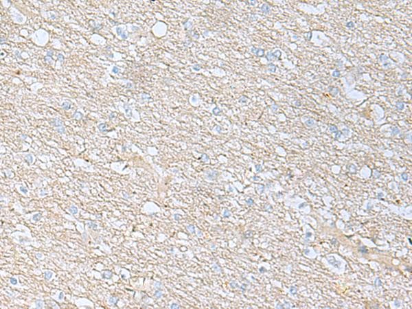 BDNF Antibody