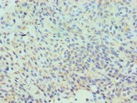 CLIC1 / NCC27 Antibody (aa42-241)