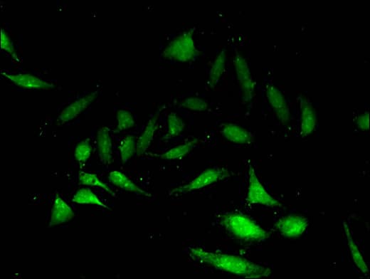 Polyclonal Rabbit anti-Human NANOS3 / NOS-3 Antibody (IHC, IF)