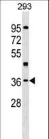 Polyclonal Rabbit anti-Human HLF Antibody (aa204-232, WB)