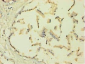 HNRNPH1 / hnRNP H Antibody (aa2-449)