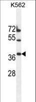 TMEM150B Antibody (aa13-41)