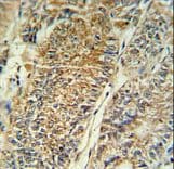 PYCR1 Antibody (aa291-319)