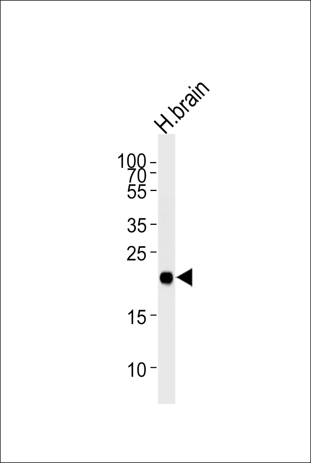 CPLX3 Antibody (aa52-81)
