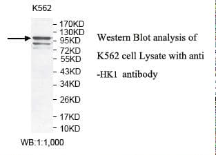 Polyclonal Rabbit anti-Human HK1 / Hexokinase 1 Antibody (aa351-629, IHC, WB)