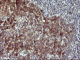 IL1A / IL-1 Alpha Antibody (clone OTI2F8)