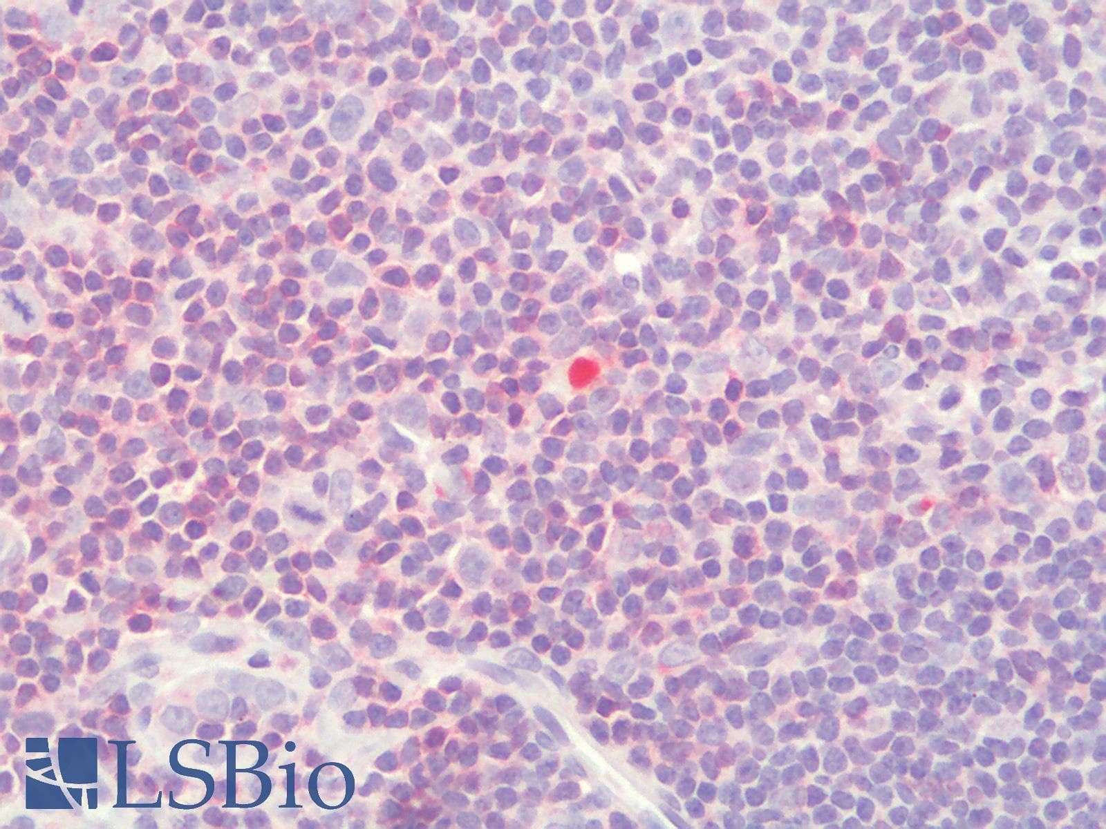 PathPlus™ CD3E Antibody