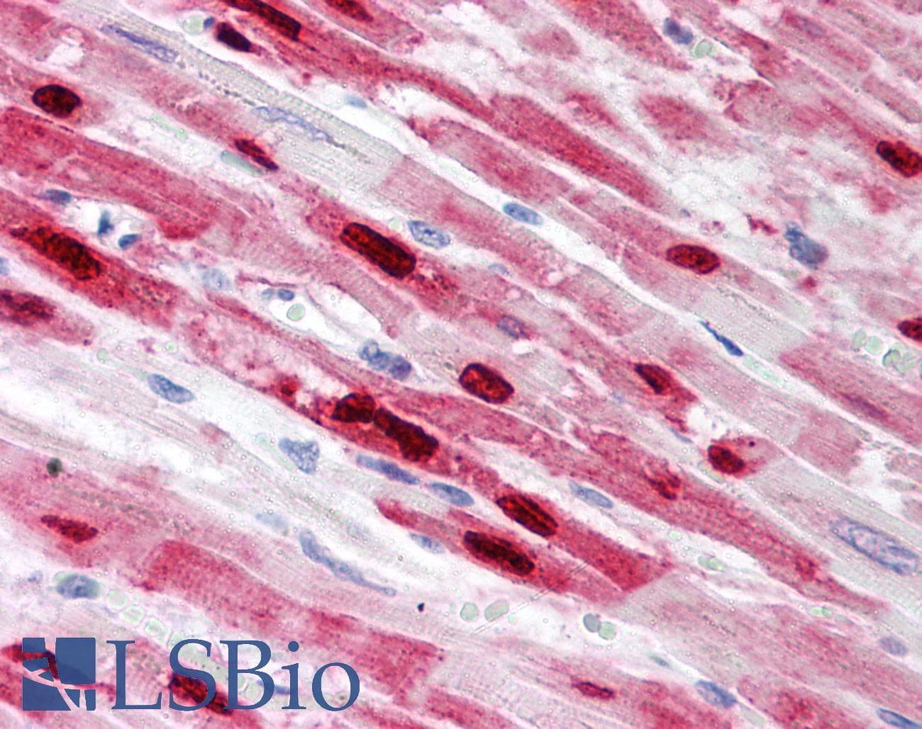 IHC-plus™ PLA2G2A / SPLA2 Antibody