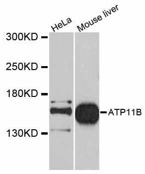 ATP11B Antibody