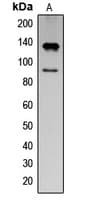 Polyclonal Rabbit anti-Human IFNAR1 / IFNAR Antibody (phospho-Tyr466, WB)