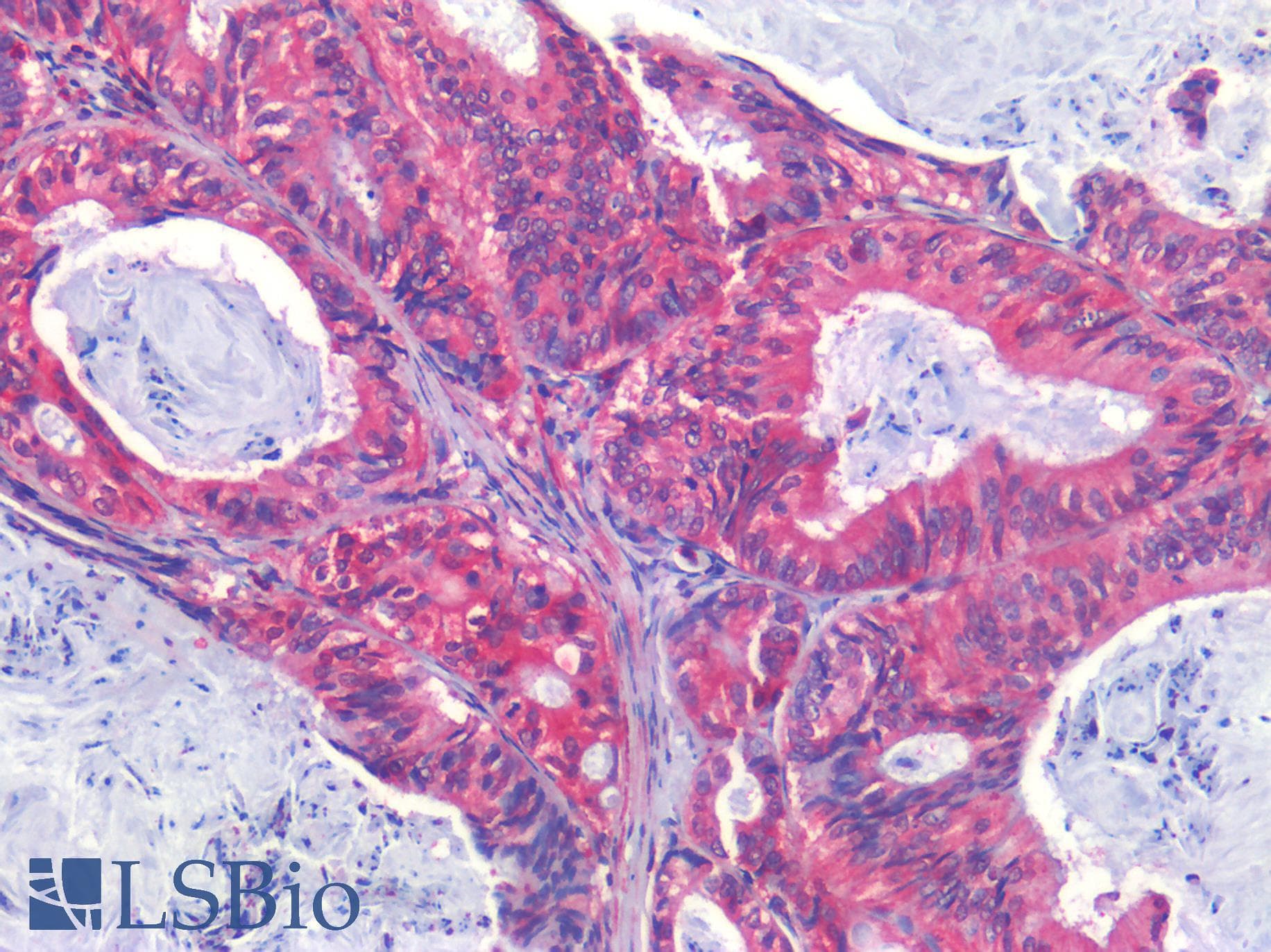 PathPlus™ Polyclonal Rabbit anti-Human EPHB2 / EPH Receptor B2 Antibody (C-Terminus, IHC)