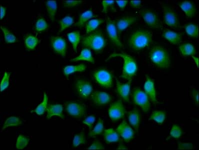 Polyclonal Rabbit anti-Human TAF4B Antibody (IHC, IF)