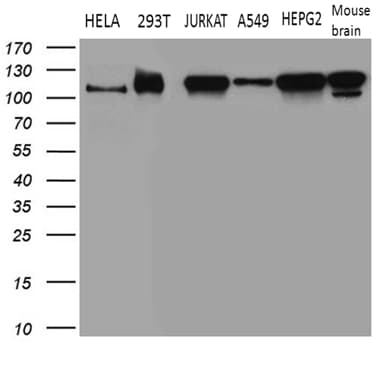 NSD3 / WHSC1L1 Antibody (aa427-566, clone OTI6A12)