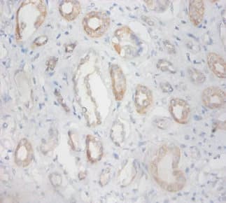 ZNF91 Antibody
