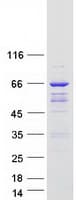 Human ARHGAP9 Protein (Recombinant Myc-DDK (Flag))