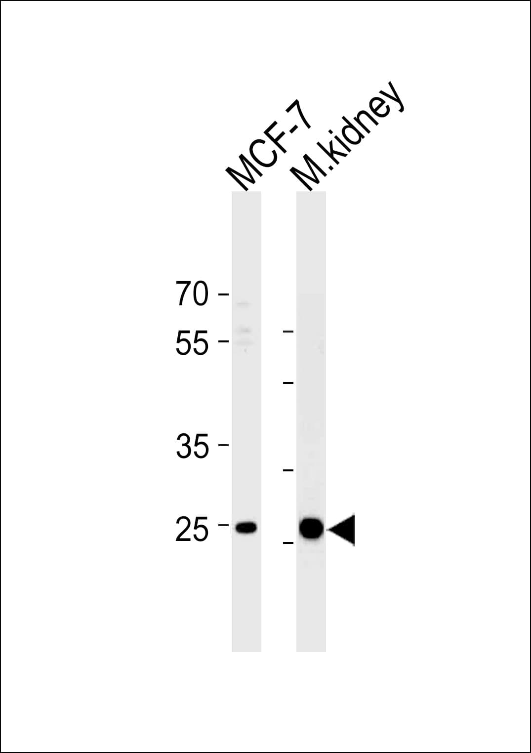 CA2 / Carbonic Anhydrase II Antibody (aa54-83)