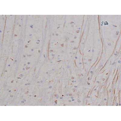 NPM1 / NPM / Nucleophosmin Antibody (phospho-Thr199)