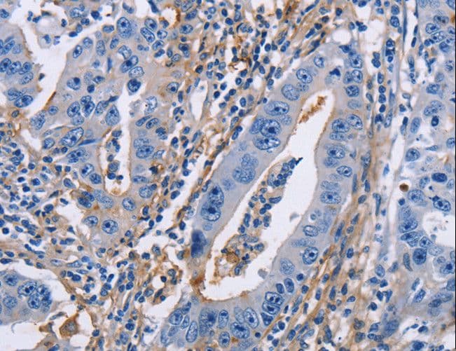 Polyclonal Rabbit anti-Human ICAM-1 / CD54 Antibody (IHC, WB)