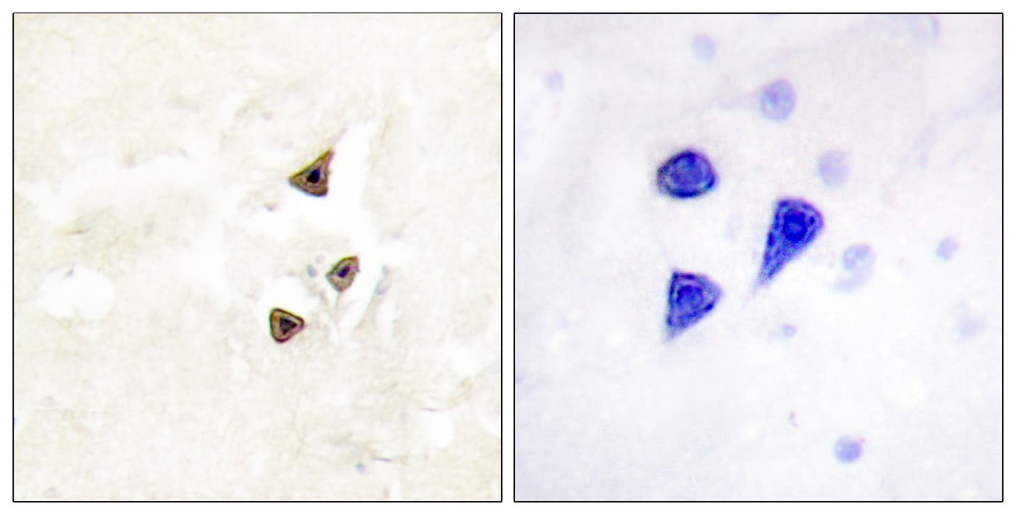 NTRK2 / TRKB Antibody (phospho-Tyr515)