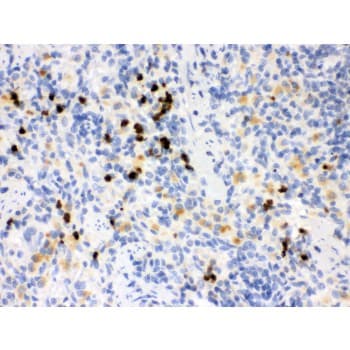 Polyclonal Rabbit anti-Mouse MMP8 Antibody (aa120-157, IHC, WB)