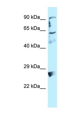Polyclonal Rabbit anti-Human EPLIN Antibody (C-Terminus, IHC, WB)