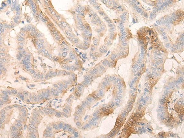 Polyclonal Rabbit anti-Human MPPED2 Antibody (IHC)