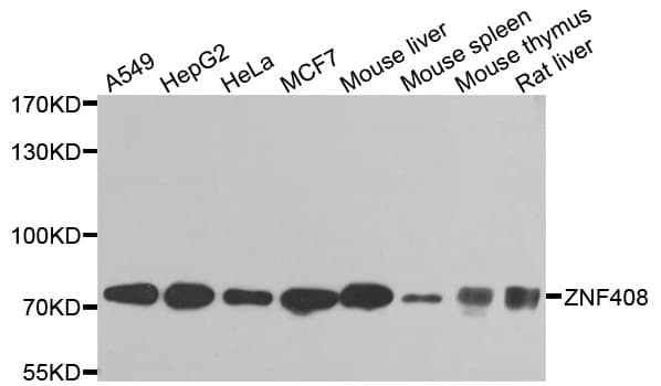 Polyclonal Rabbit anti-Human ZNF408 / PRDM17 Antibody (IHC, WB)