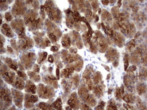 Acidic Cytokeratin Antibody (clone 3E10)