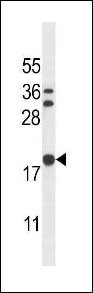 SCLIP / STMN3 Antibody (aa148-177)