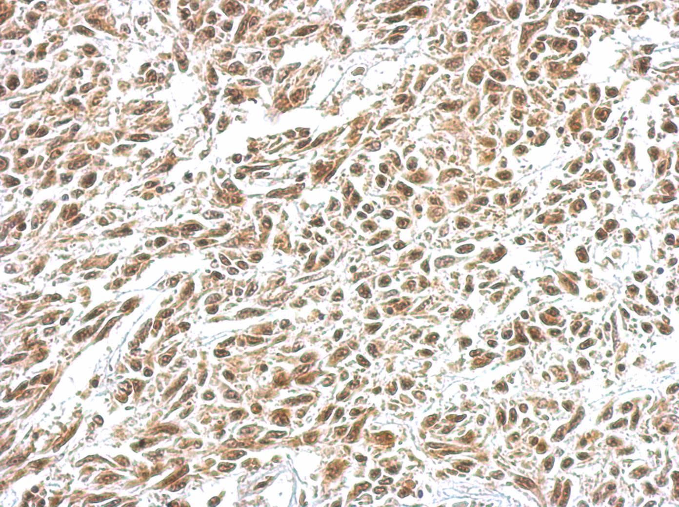 NFKBIA / IKB Alpha / IKBA Antibody (aa1-317)