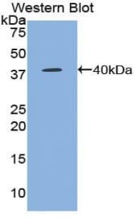 CCL5 / RANTES Antibody (aa24-91)