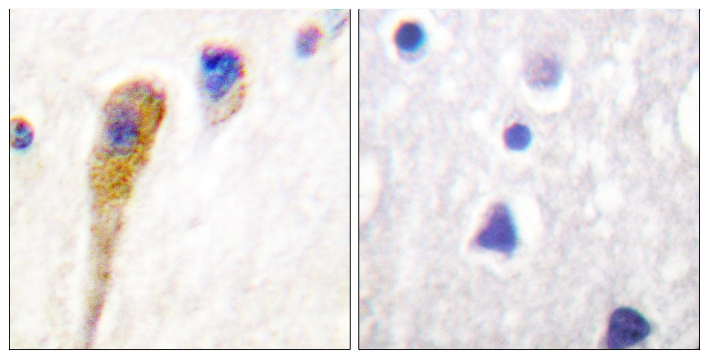 FAK / Focal Adhesion Kinase Antibody (p576)