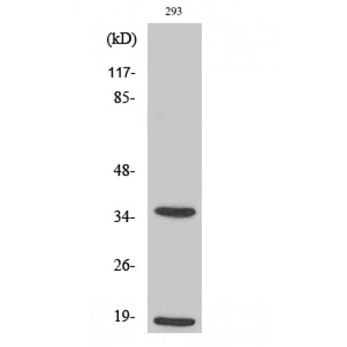 Polyclonal Rabbit anti-Human CASP6 / Caspase 6 Antibody (90-170 aa, Internal, IHC, WB)