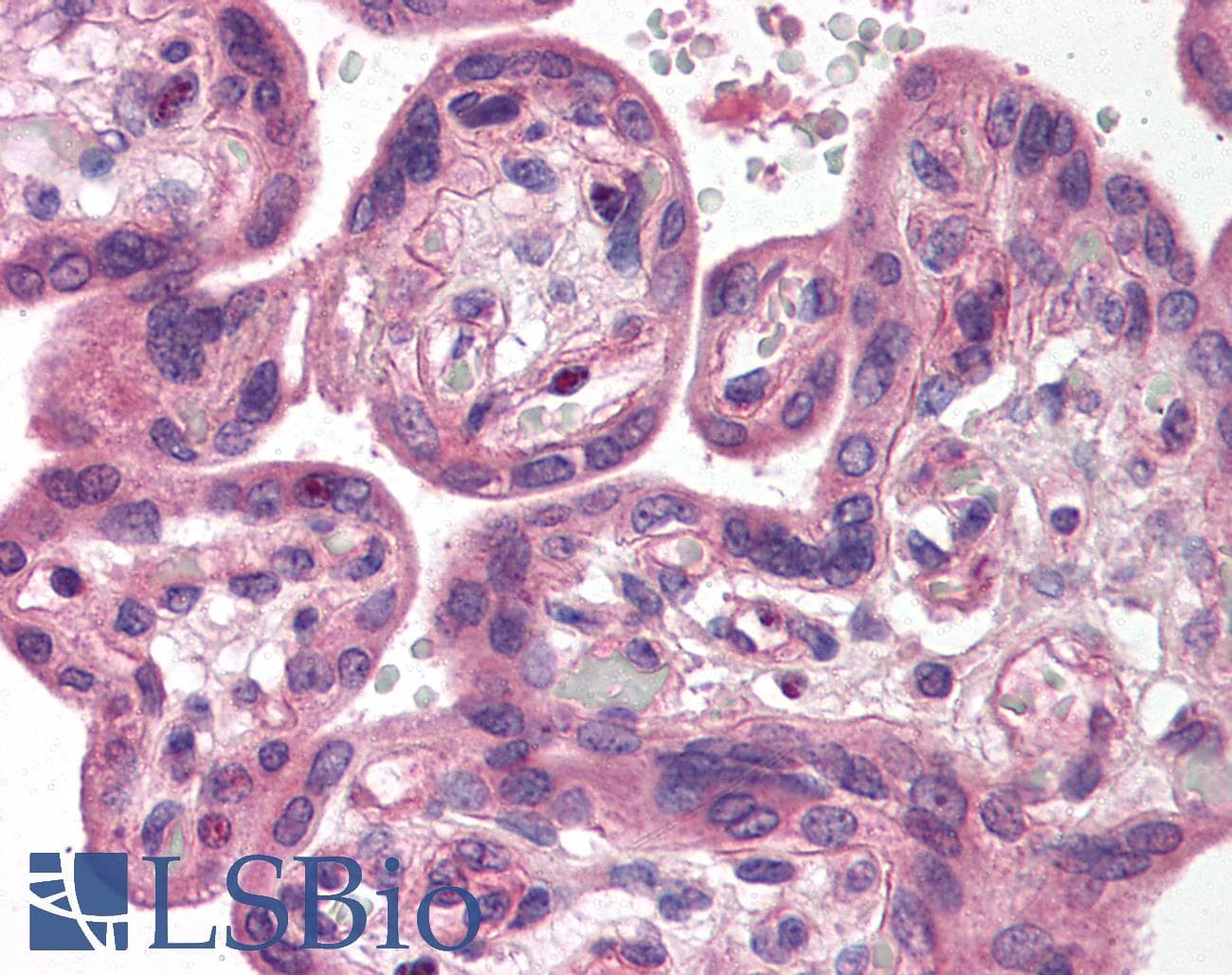 IHC-plus™ Polyclonal Rabbit anti-Human SH3GLB1 / Bif / Endophilin B1 Antibody (IHC, WB)