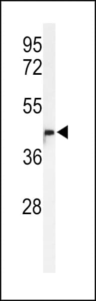 Polyclonal Rabbit anti-Human METT11D1 Antibody (aa88-116, IHC, WB)