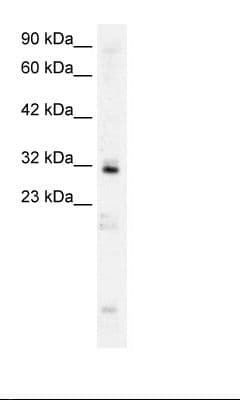 Polyclonal Rabbit anti-Human HOXB9 Antibody (aa67-116, IHC, WB)