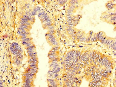 KIR2DL1 / CD158a Antibody