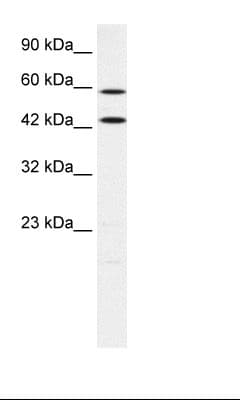 Polyclonal Rabbit anti-Human FACL2 / ACSL1 Antibody (aa619-668, IHC, WB)