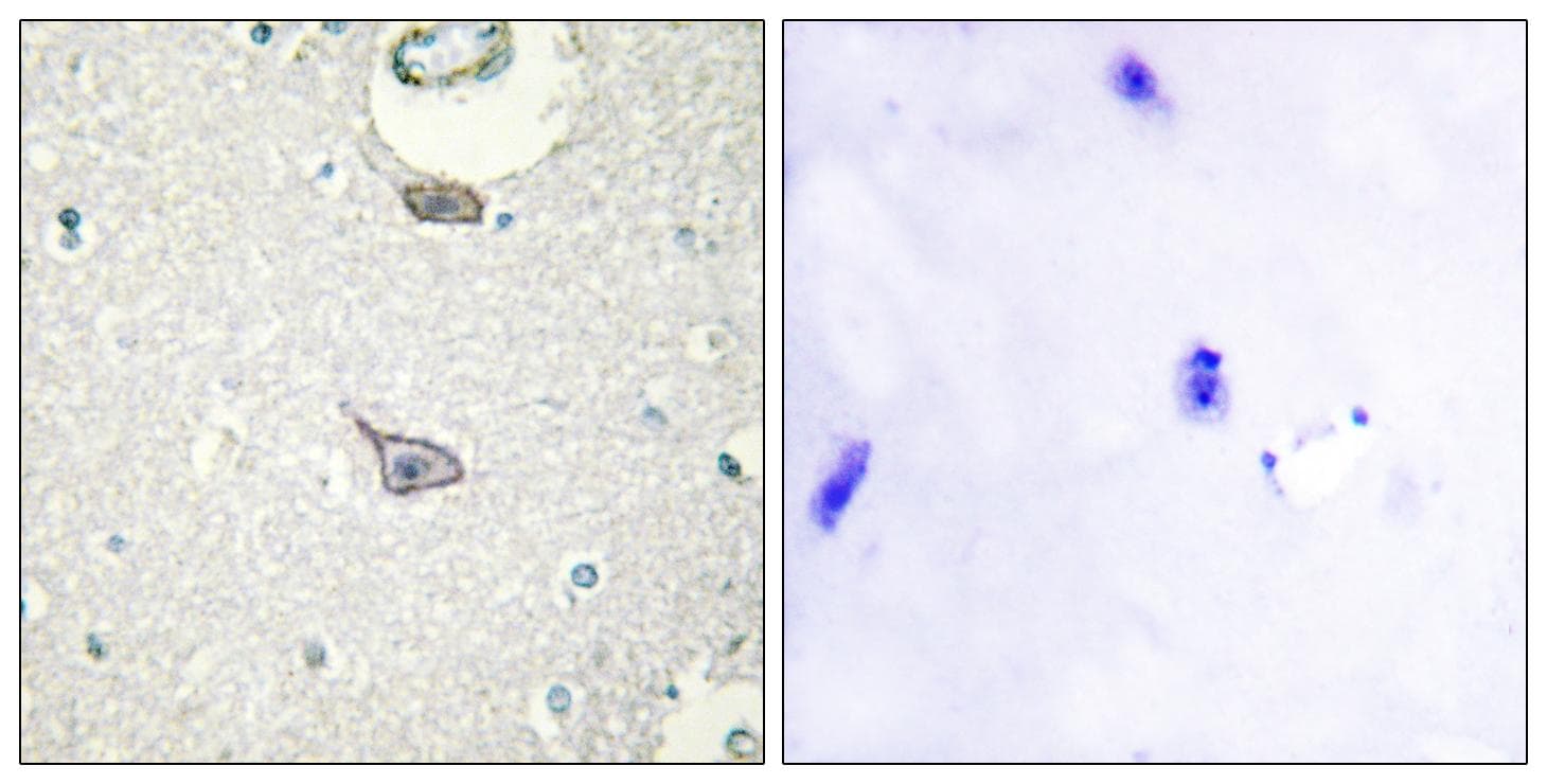 IGSF4C / CADM4 Antibody