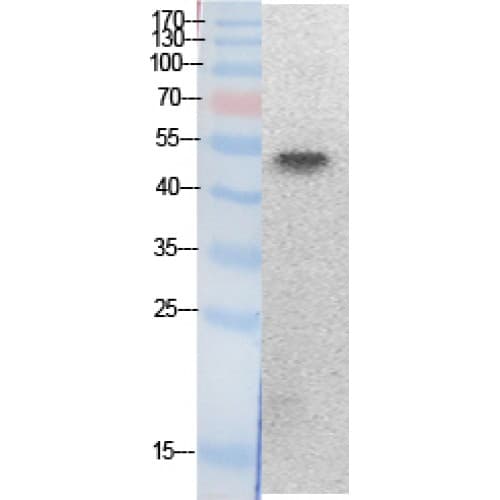 Polyclonal Rabbit anti-Human PTEN Antibody (around the acetylation site of K402., WB)