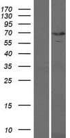 KBTBD10 / Sarcosin Protein (Over-Expression Lysate Myc-DDK (Flag))